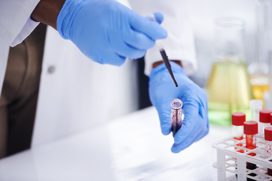 New Molecular Mechanism in Fat Cells Reshapes Understanding of Obesity
