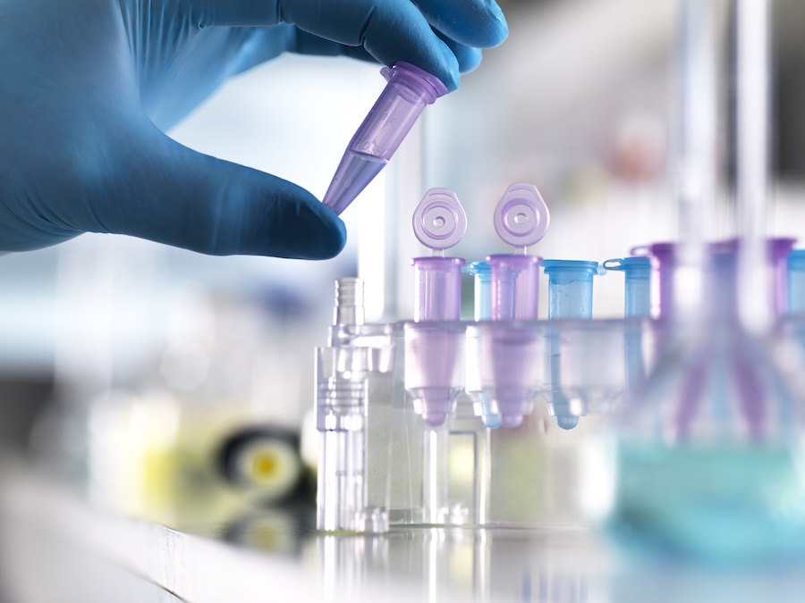 Gut Microbiome Found to Mediate Diet’s Impact on Metabolic Risk